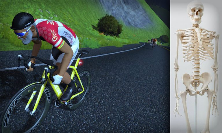 An Active Approach to Cycling Injuries: Bone Density and Virtual Cycling